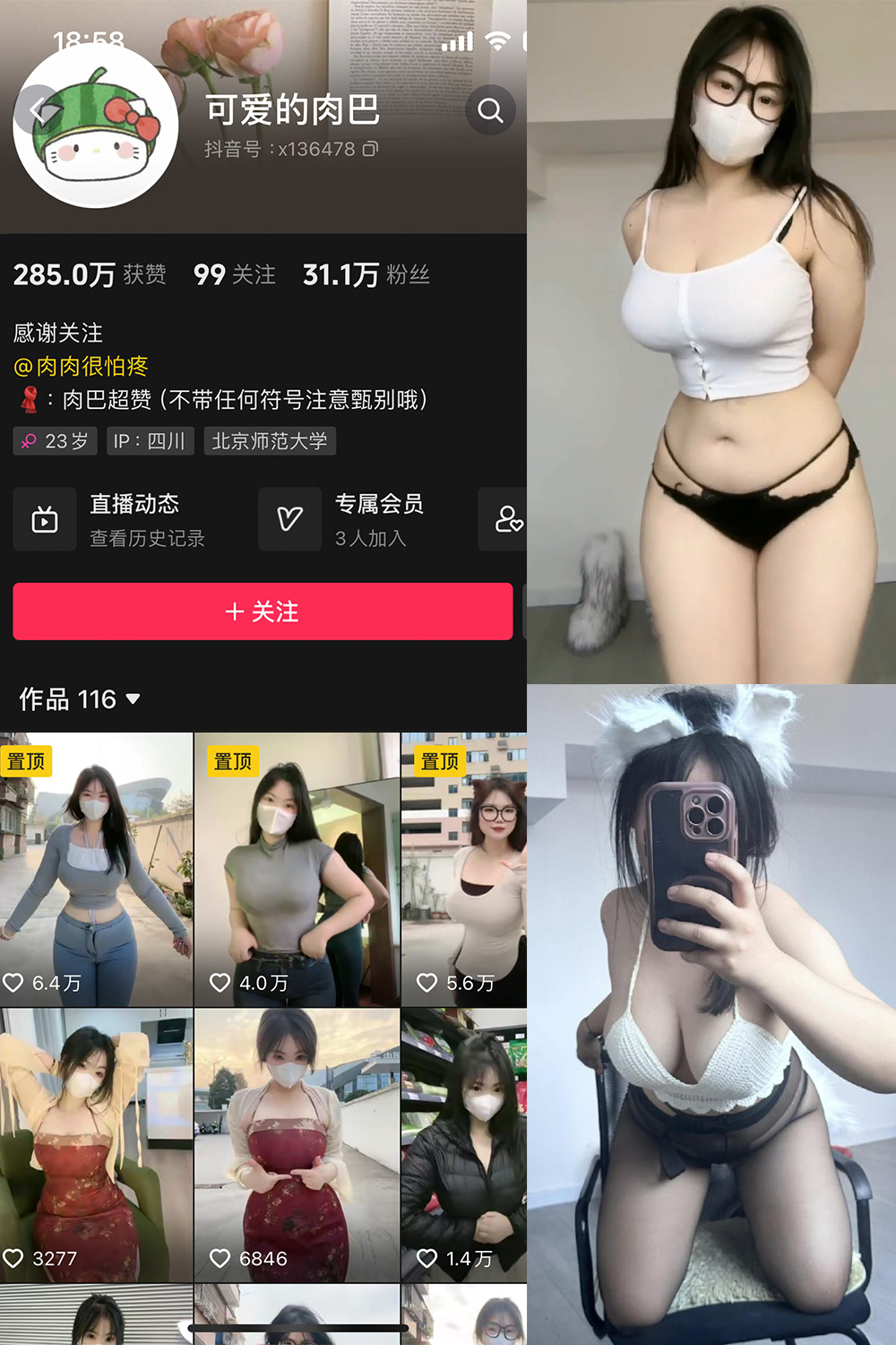 抖音 可爱的肉巴 微密圈图片资源  NO.014期 【19P12V】最新至：2024.3.7