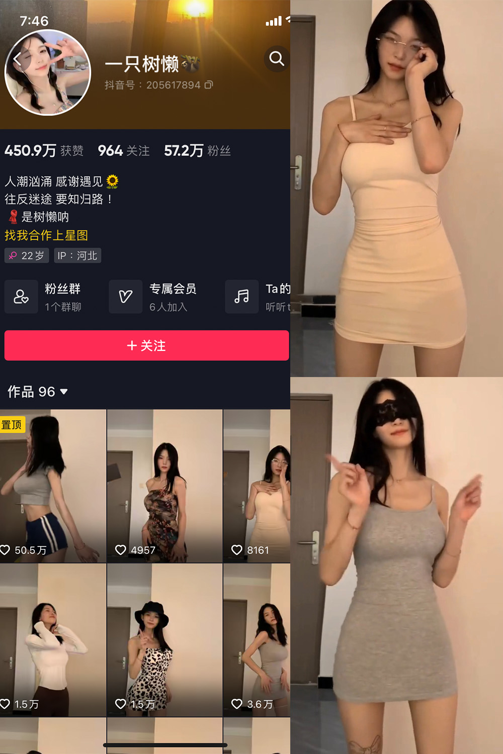 抖音 一只树懒 微密圈图片资源  NO.003期 【2P10V】