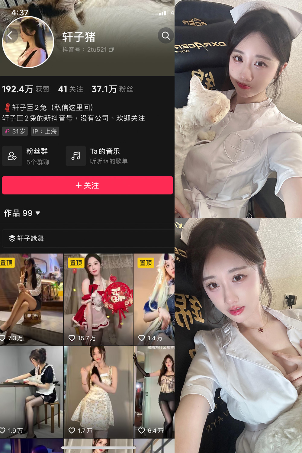 抖音 轩子巨二兔 微密圈图片资源  NO.023期 【8P1V】最新至：2024.3.15