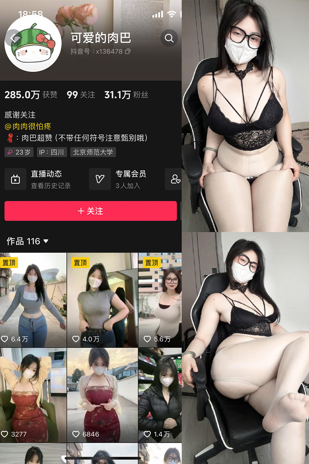 抖音 可爱的肉巴 微密圈图片资源 NO.022期 【25V】最新至:2024.4.25 抖音 可爱的肉巴 微密圈图片资源 NO.022期 【25V】最新至:2024.4.25