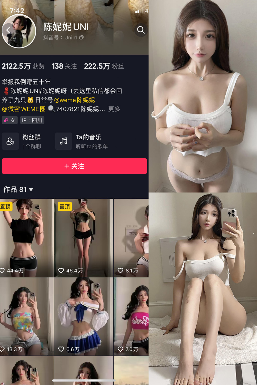 抖音 陈妮腻UNI 微密圈图片资源  NO.063期 【24P1V】