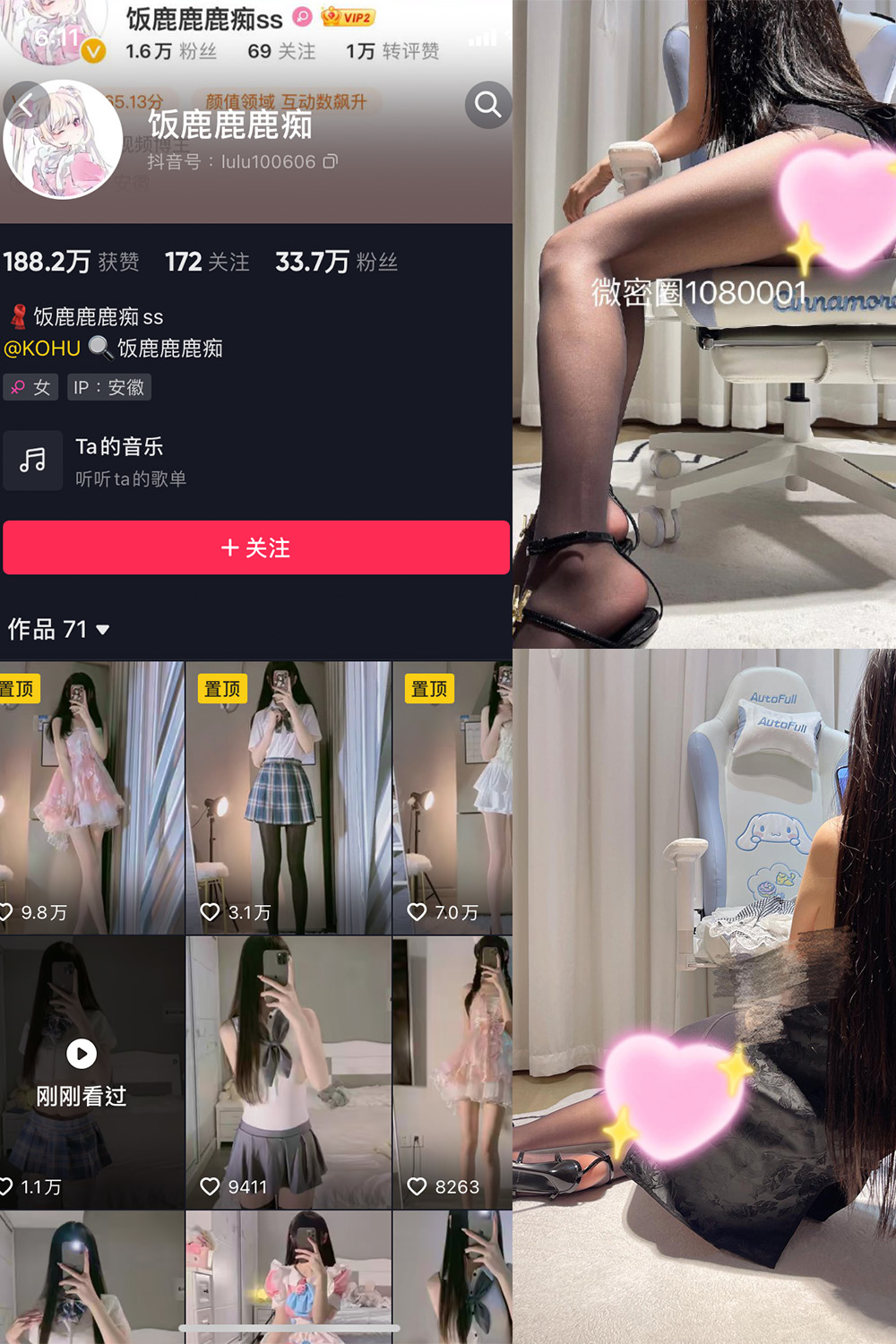 抖音 饭鹿鹿痴 微密圈图片资源  NO.018期 【9P1V】最新至：2023.12.02
